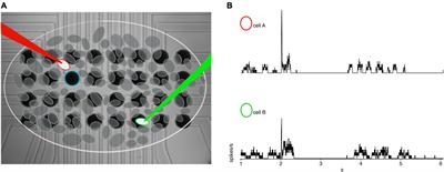 Differences in the spatial fidelity of evoked and spontaneous signals in the degenerating retina